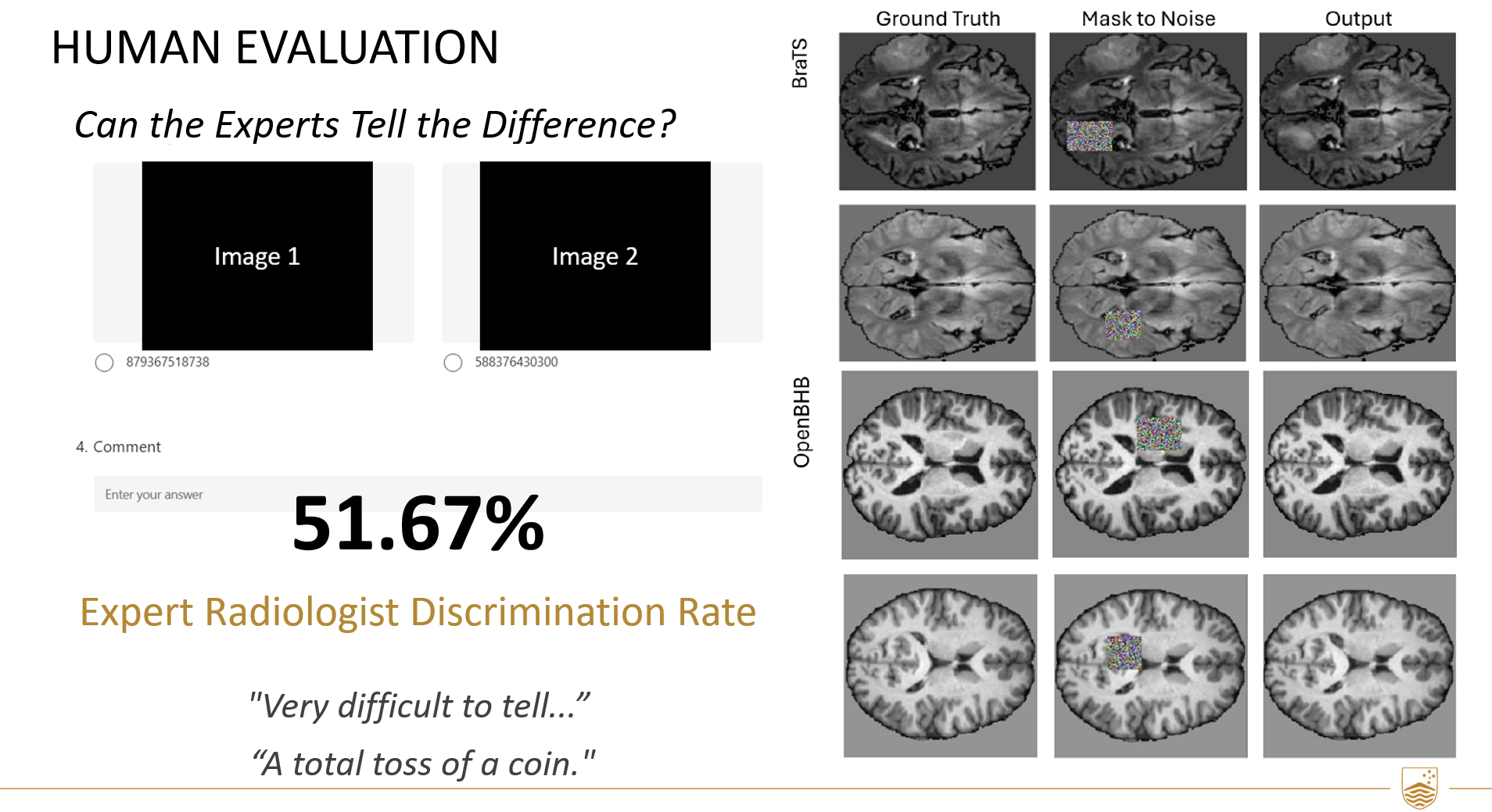 Human evaluation: expert radiologists distinguished generated scans from real ones only 51.67% of the time — essentially chance.