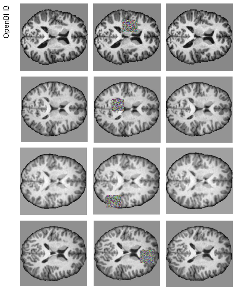 Ground truth, masked input, and model output on BraTS and OpenBHB brain MRI.